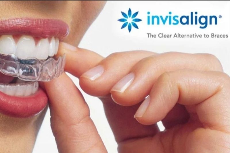 Tampa Invisalign